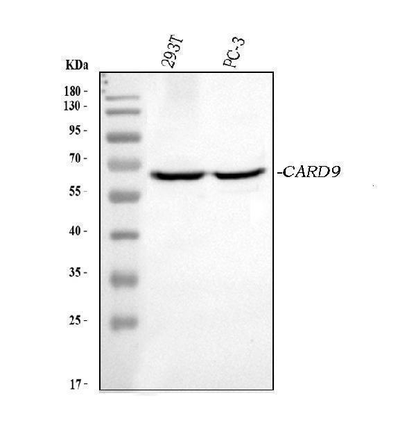 a01410 1 card9 primary antibodies wb testing 1_1