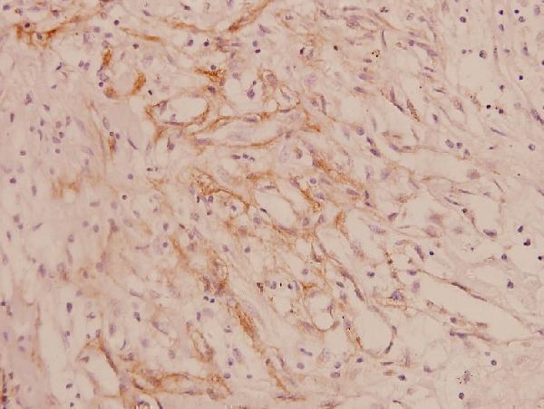 a01411 1 col4a1 primary antiboties ihc testing 2