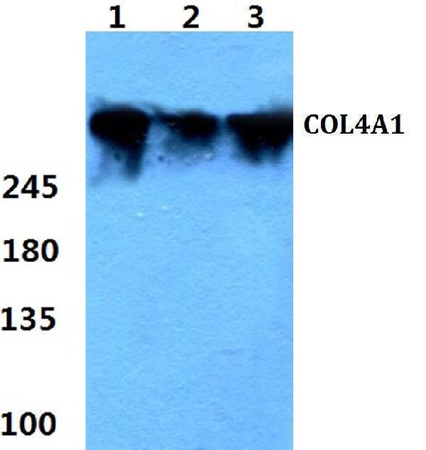 a01411 1 col4a1 primary antiboties wb testing 1