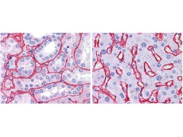 a01411 collagen iv primary antibodies ihc testing 1_1