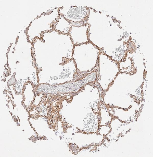 a01411 collagen iv primary antibodies ihc testing 2_1