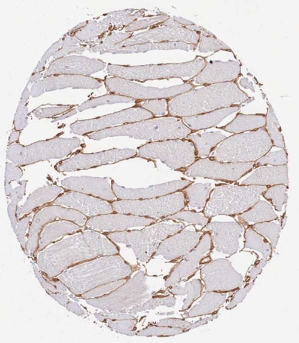 a01411 collagen iv primary antibodies ihc testing 3_1