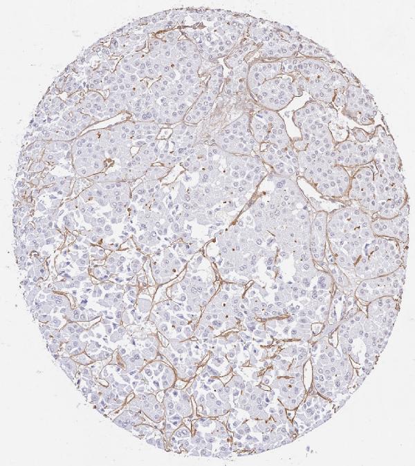 a01411 collagen iv primary antibodies ihc testing 4_1