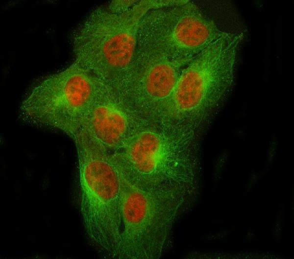  IF analysis of NCOR2 using anti-NCOR2 antibody (A01412-2) and anti-Beta Tubulin antibody (M01857-3)