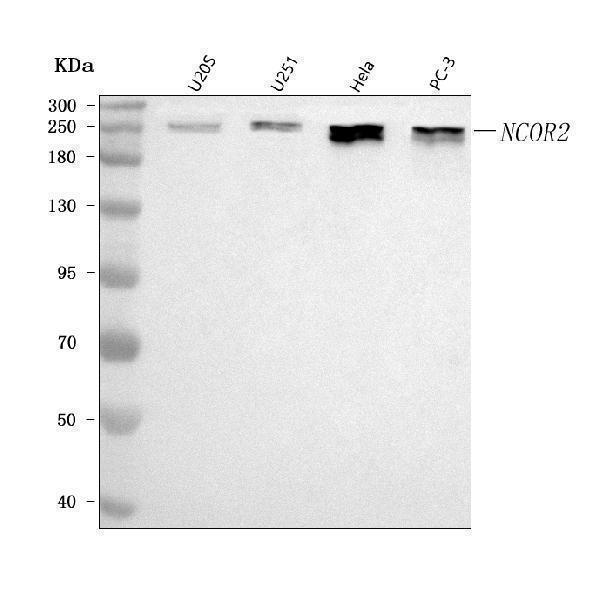  Western blot analysis of NCOR2 using anti-NCOR2 antibody (A01412-2)