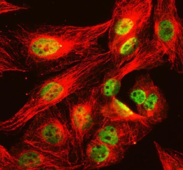 a01412 3 ncor2 primary antibodies if testing 1
