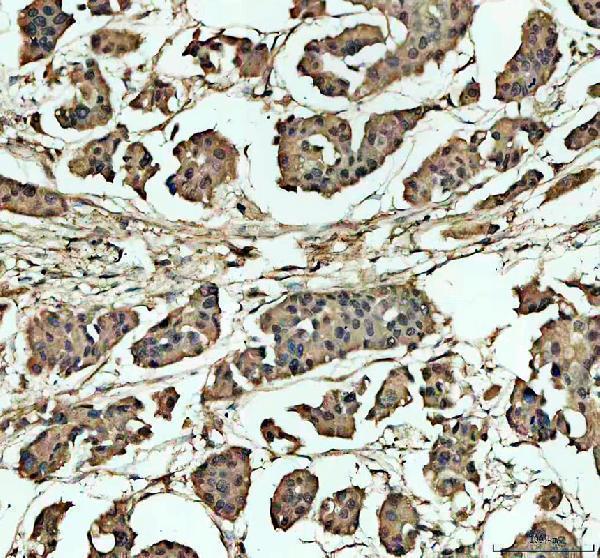a01412 3 ncor2 primary antibodies ihc testing 1