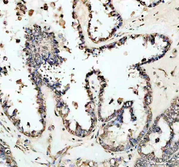 a01412 3 ncor2 primary antibodies ihc testing 2