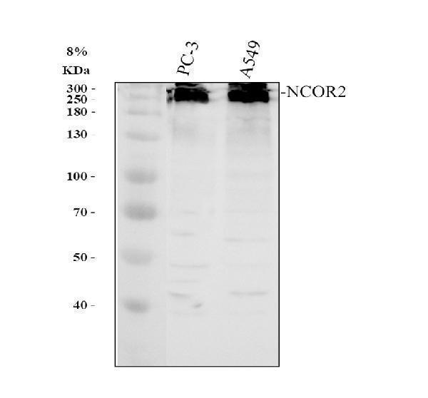 a01412 3 ncor2 primary antibodies wb testing 1