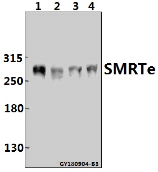 a01412 ncor2 primary antiboties wb testing 1
