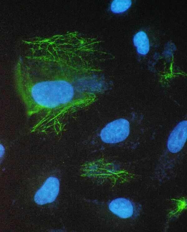  IF analysis of SCNN1A using anti-SCNN1A antibody (A01413-1)