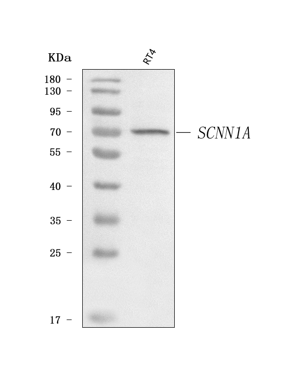  Western blot analysis of Epithelial Sodium Channel Alpha/SCNN1A using anti-Epithelial Sodium Channel Alpha/SCNN1A antibody (A01413-2)