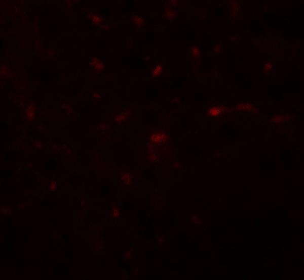 a01414 trb3 primary antibodies if testing 3