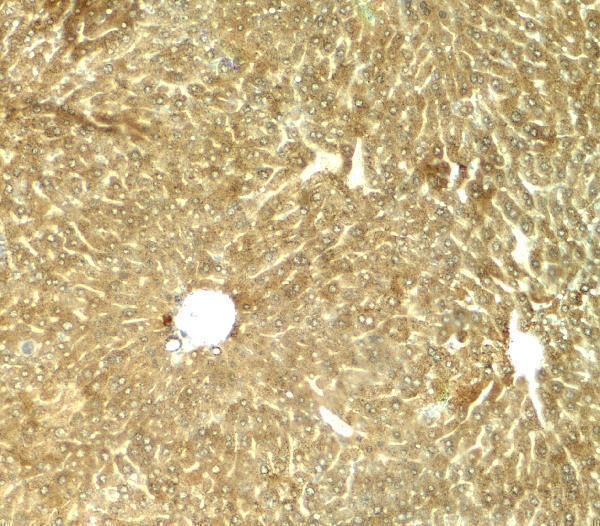 a01414 trb3 primary antibodies ihc testing 2