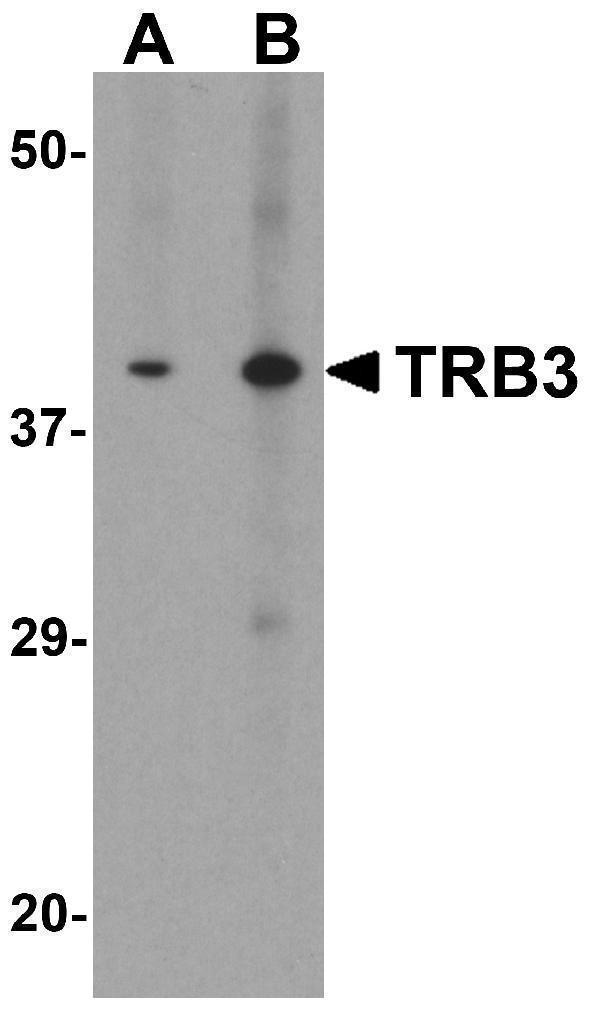 a01414 trb3 primary antibodies wb testing 1
