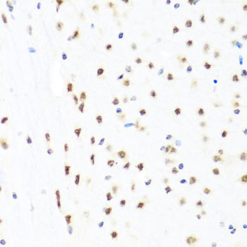 a01415 gata2 primary antiboties ihc testing 2