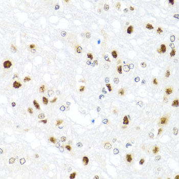 a01415 gata2 primary antiboties ihc testing 3