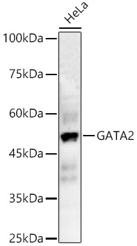a01415 gata2 primary antiboties wb testing 1
