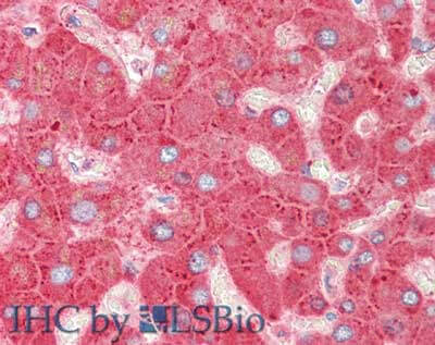 Immunohistochemistry of goat anti-Apolipoprotein C-III antibody