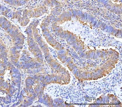 a01418 2 rars1 primary antibodies ihc testing 2