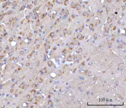 a01418 2 rars1 primary antibodies ihc testing 3