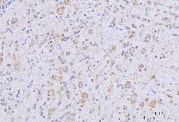 a01418 2 rars1 primary antibodies ihc testing 4