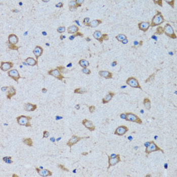 a01418 rars primary antiboties ihc testing 2
