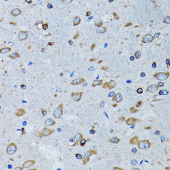 a01418 rars primary antiboties ihc testing 4