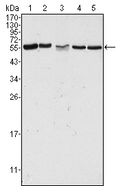 Western Blot analysis using PAKγ Monoclonal Antibody against HeLa (1), Jurkat (2), A549 (3), HEK293 (4) and K562 (5) cell lysate