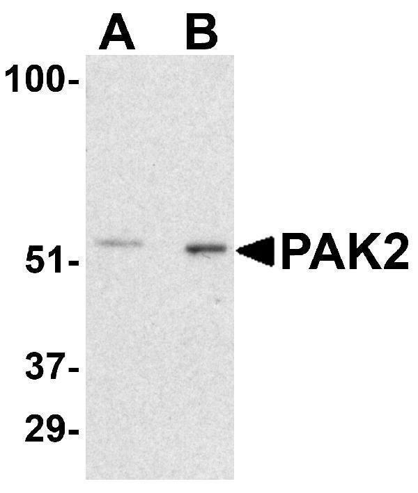 a01419 2 pak2 primary antibodies wb testing 1