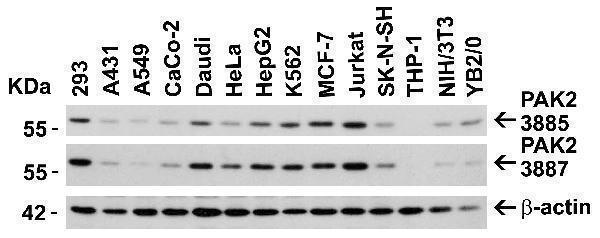 a01419 2 pak2 primary antibodies wb testing 2