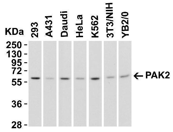 a01419 2 pak2 primary antibodies wb testing 3