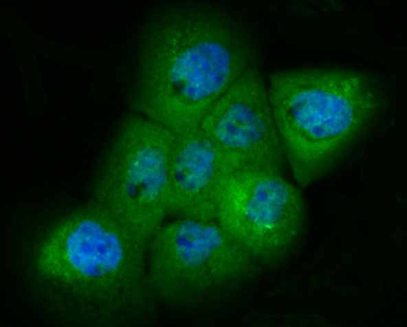  ICC staining PAK2 in A431 cells (green)