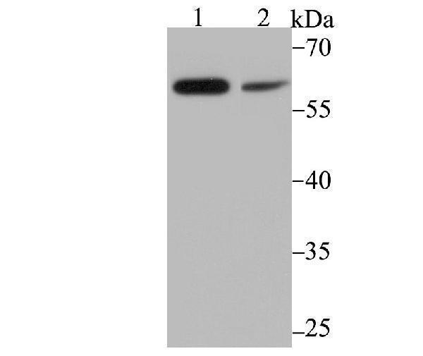 Western blot analysis of PAK2 on mouse thymus tissue (1) and MCF-7 cell (2) lysate using anti-PAK2 antibody at 1/500 dilution