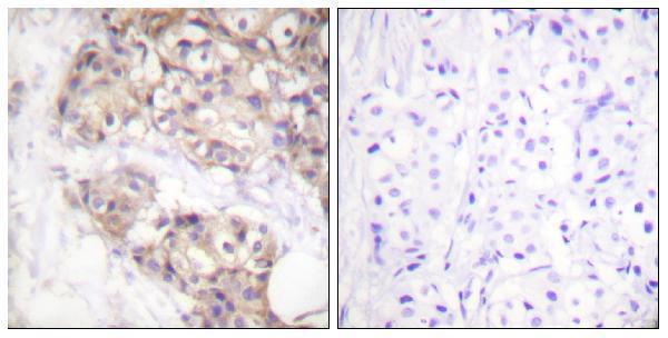 Immunohistochemistryt analysis of paraffin-embedded human brain, using PAK2 Antibody
