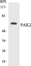 Western blot analysis of the lysates from COLO205 cells using PAK2 antibody