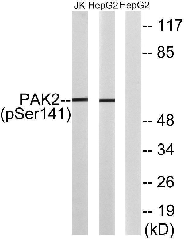 Western blot analysis of lysates from HepG2 cells treated with Adriamycin 0