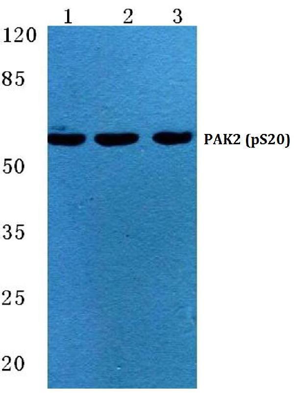 Western blot (WB) analysis of p-PAK2 (S20) polyclonal antibody at 1:500 dilution
Lane1:HEK293T cell lysate treated with EGF(0