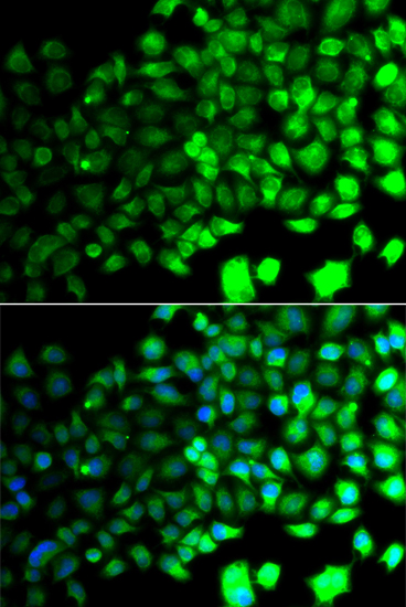 Western blot analysis of extracts of various cell lines, using AMPKα2 antibody  at 1:500 dilution