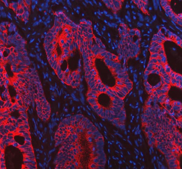 a01421 krt8 primary antibodies if testing 1