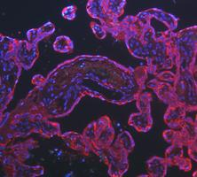 a01421 krt8 primary antibodies if testing 13