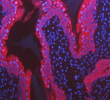 a01421 krt8 primary antibodies if testing 14