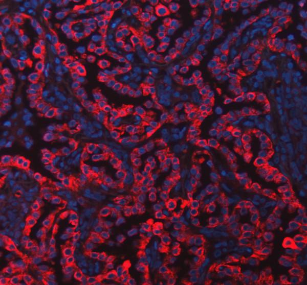 a01421 krt8 primary antibodies if testing 2