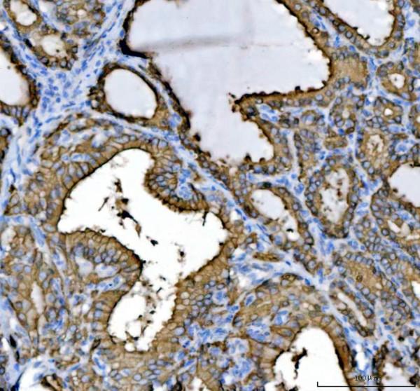 a01421 krt8 primary antibodies ihc testing 1