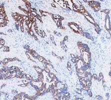 a01421 krt8 primary antibodies ihc testing 10_1