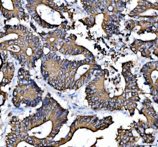 a01421 krt8 primary antibodies ihc testing 2