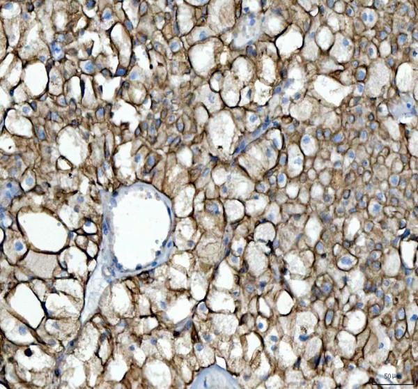 a01421 krt8 primary antibodies ihc testing 3