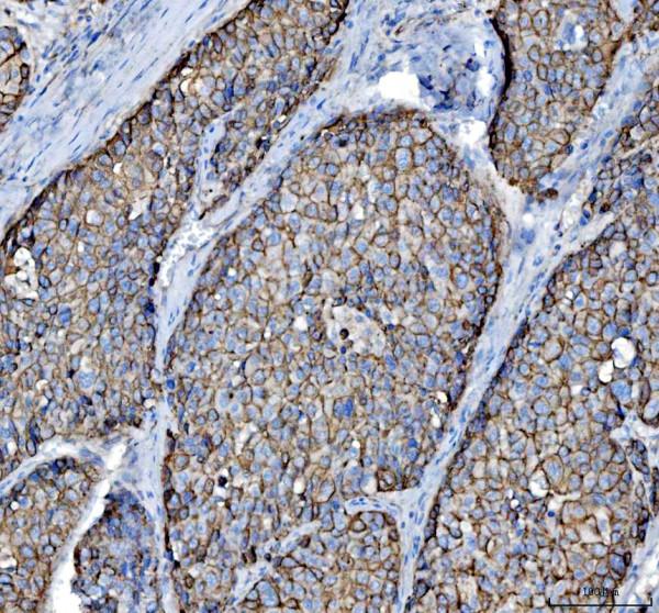 a01421 krt8 primary antibodies ihc testing 4