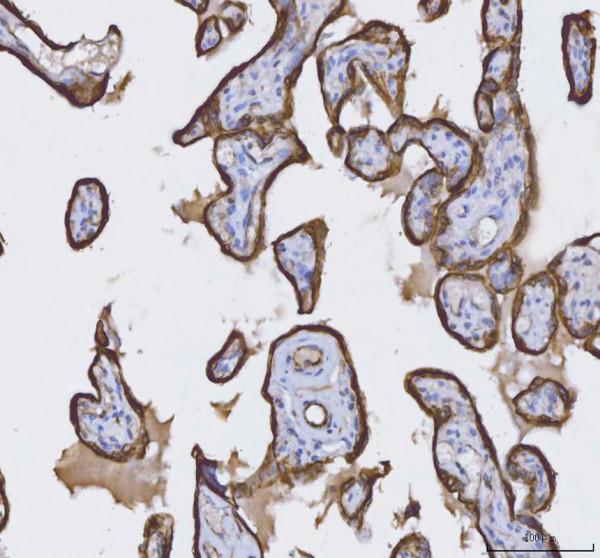 a01421 krt8 primary antibodies ihc testing 5