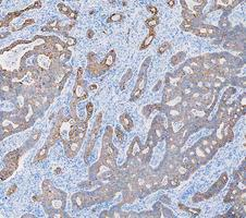 a01421 krt8 primary antibodies ihc testing 6_1